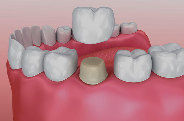Treatment - 53 Wimpole Street